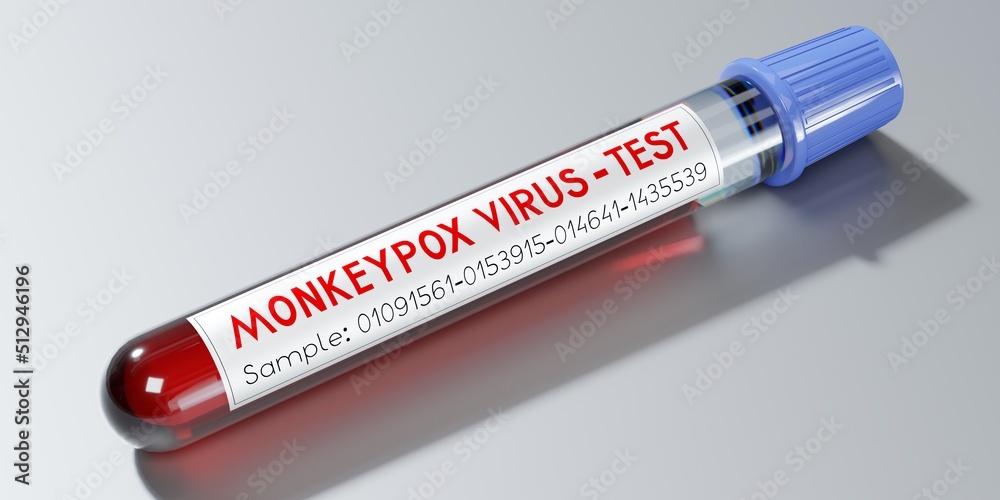 Monkey pox virus blood test vial - 3D illustration
