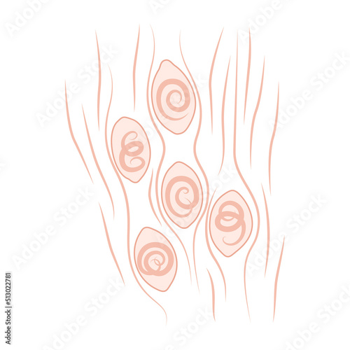 Sample of striated muscle tissue under the microscope demonstrating the parasites of Trichinella spiralis species