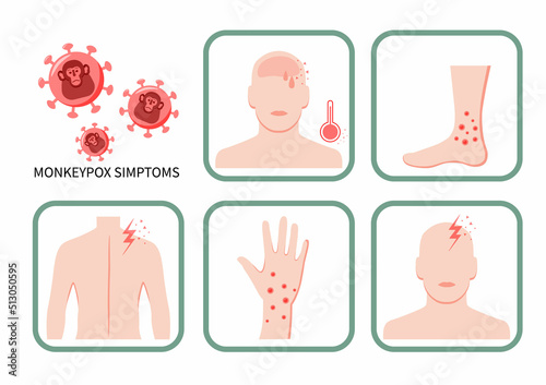 Vector illustration infographic about the symptoms of monkeypox