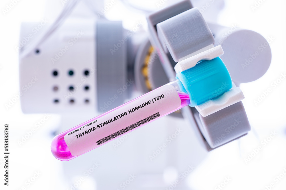 Thyroid-stimulating hormone (TSH). Test tube with artificial hormone in robot hand Thyroid-stimulating hormone (TSH)
