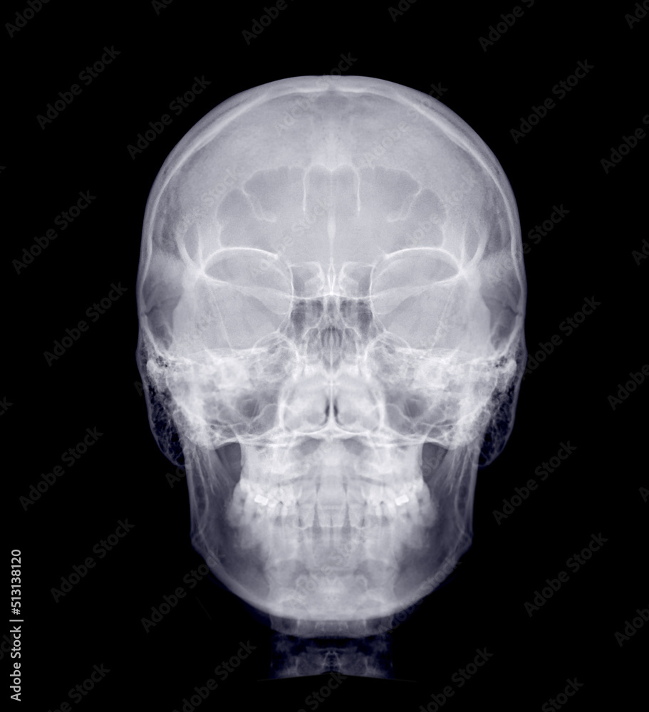 Skull x-ray image of Human front view . Skull x-ray image of Human front view .