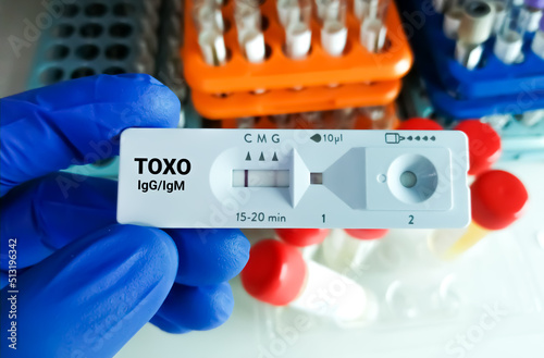 Rapid test cassette for Toxoplasma Antibody test. toxoplasma gondii photo