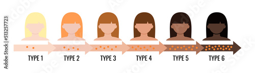 Fitzpatrick skin tone phototype  melanin index chart with female avatar. Graphic design element with type I II III IV V IV human skin hair color melanin content in the cell flat vector illustration photo