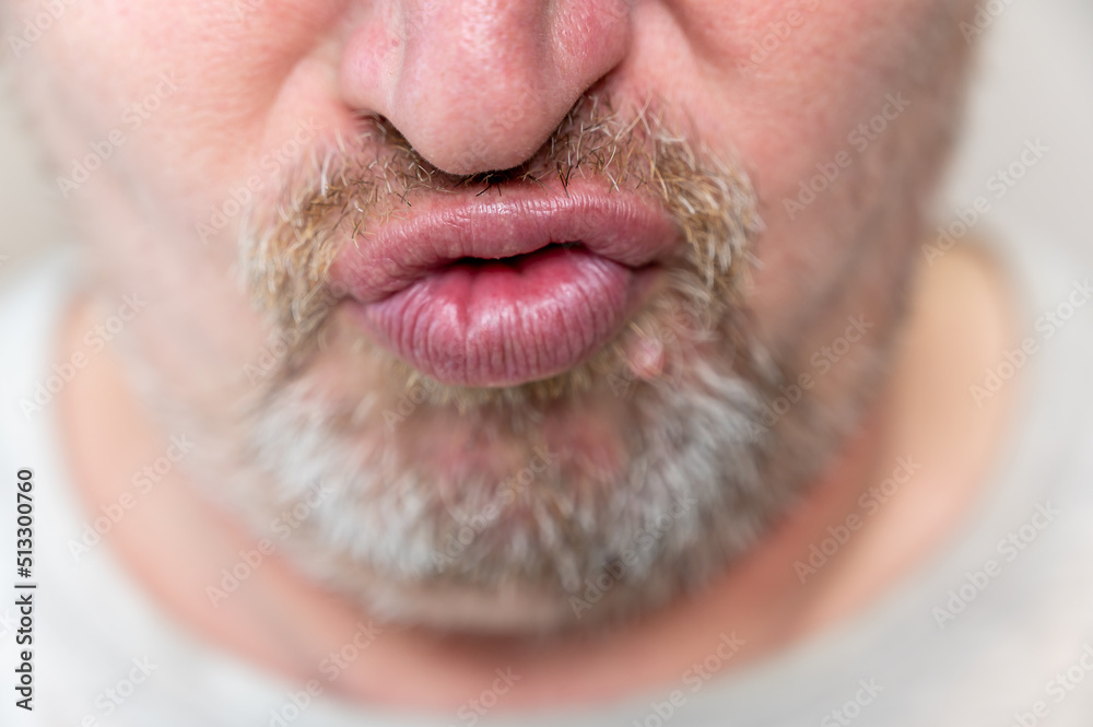 Obraz premium A mature man is crooked. The lower part of the male face. The man has his mouth gathered into a tube, grimacing. Male with stubble. Gray hair on his beard and mustache. Close-up. Selective focus.