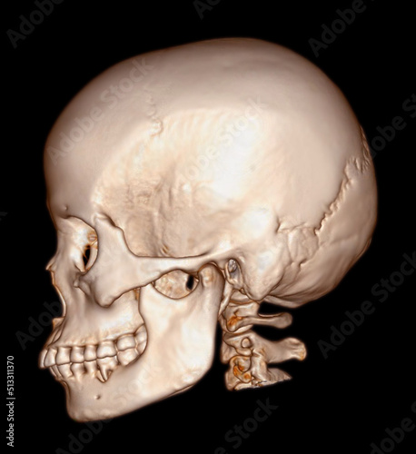 Принти на полотні Skull 3D from CT Scan of facial bone 3D rendering showng human skull
