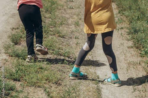 A child with crooked legs in the street, knock-knee