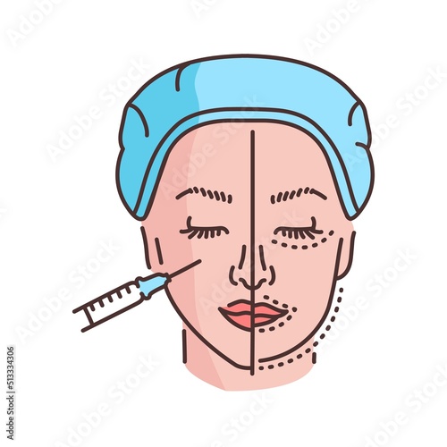 Harmonization of the profile with a filler  color line illustration. Hyaluronic injection.