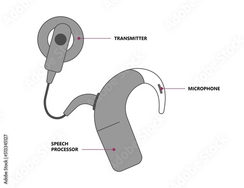 hearing aid ear child deaf signal baby inner middle bone loss outer canal birth meniere's cochlea brain implantation test exam