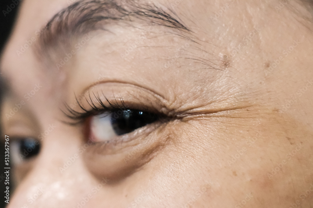 Obraz premium Close-up Face of a Woman with Wrinkled Eyelines and Eyebags due to Aging and Lack of Rest