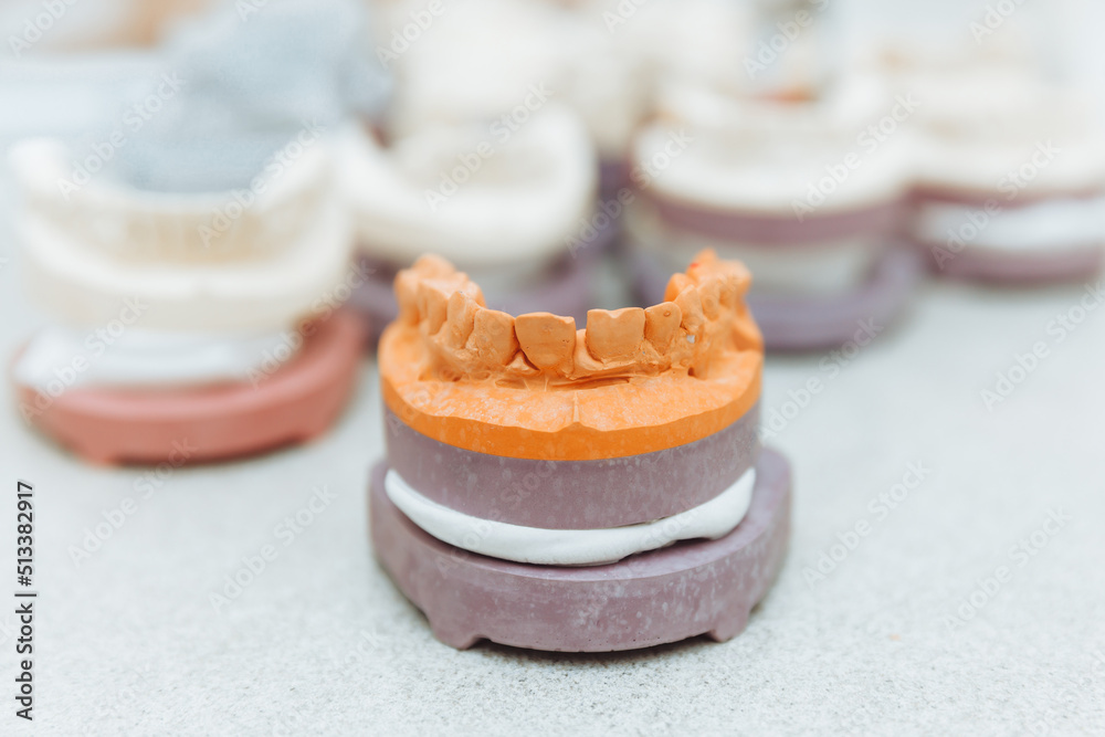 Foto de A cast of teeth. Plaster model of plaster of teeth. Dental