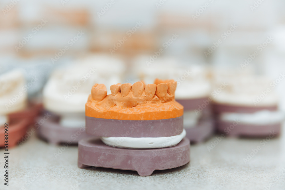A cast of teeth. Plaster model of plaster of teeth. Dental plaster cast, casts of human jaws and