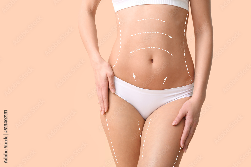 Beautiful young woman in underwear on beige background. Concept of plastic  surgery Stock Photo