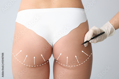 Plastic surgeon applying ma...