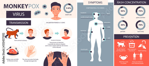 Monkey pox infographic. Infection, symptoms, prevention of the disease of monkey pox. Flat vector illustration. photo