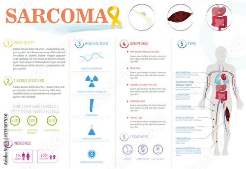 Infographic about Sarcoma disease, types, affected tissues, treatment, incidence and symptoms, on white background. photo