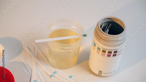 A close-up of a medical laboratory scientist diagnosing of ketonuria by using ketone screening test strip. Litmus paper changes color. Glucose in urine. Diabetes. 
