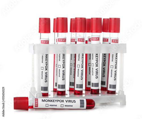 Test tubes with blood sampl...