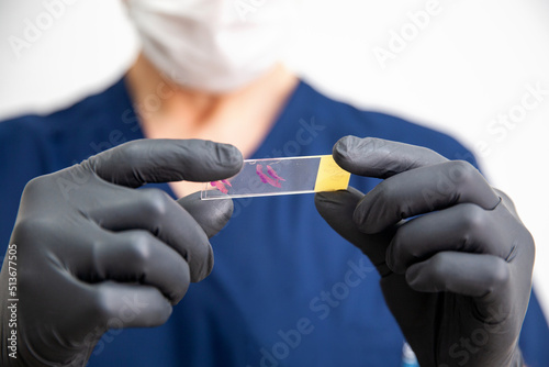 doctor in black gloves holds stained histology slide which is ready for microscopic examination. Cytology.  photo