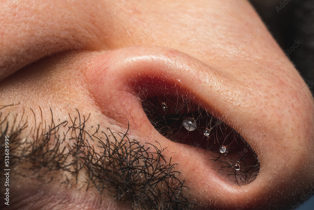 A detail shot of frozen water droplets in a nose at winter. A detail shot of frozen water droplets in a nose at winter.