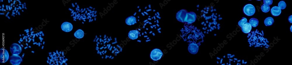 Chromosomes under fluorescence microscope, fluorescence in situ hybridization technique, Human chromosomes from blood Chromosomes under fluorescence microscope, fluorescence in situ hybridization technique, Human chromosomes from blood