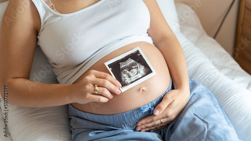 Ultrasound picture pregnant baby photo. Woman holding ultrasound pregnancy image. Concept of pregnancy, maternity, expectation for baby birth.