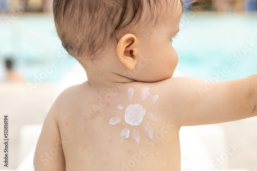 baby sitting on white beach chair with sun shape from white cream,body lotion,painted on shoulder.sun protective,pf  emulsion.toddler with allergy, red dots on back.summer vacation,sea, trip.family