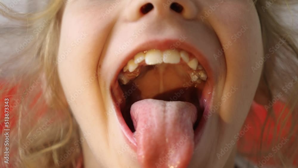 Close-up of a child's mouth wide open. The girl opens her mouth wide and sticks out her long tongue. The kid shows her teeth and soft palate ▶0:08 ▶0:08   