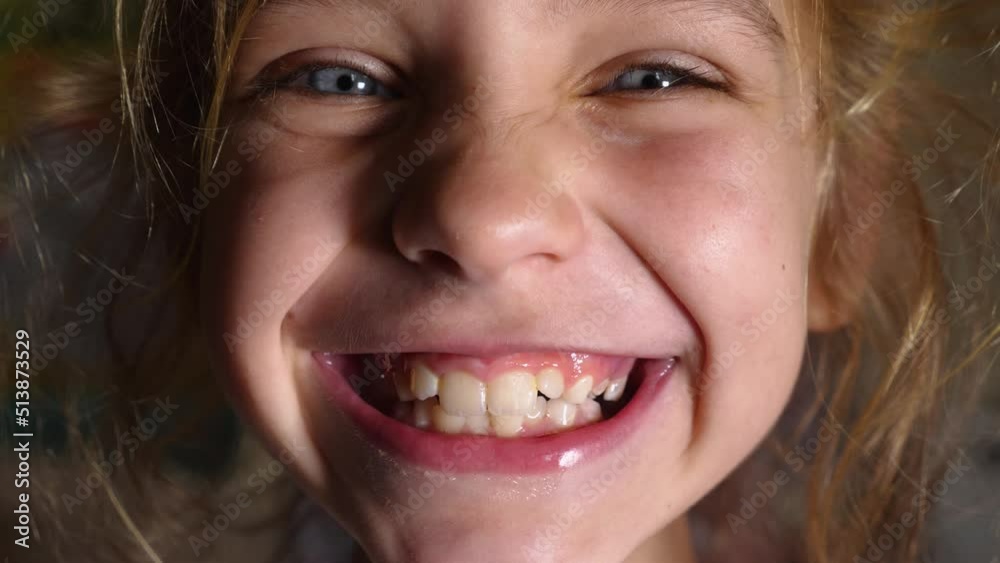 Close-up of the child's face of a girl who has clenched her teeth hard. The girl is showing her bite. A girl with blue eyes clenched her teeth hard Close-up of the child's face of a girl who has clenched her teeth hard. The girl is showing her bite. A girl with blue eyes clenched her teeth hard
