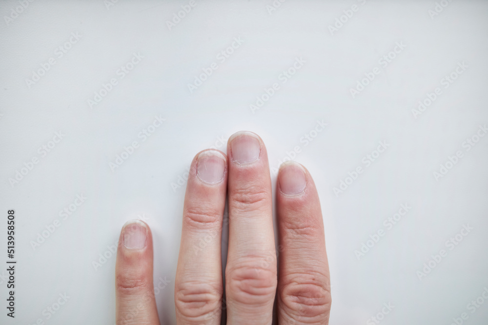 untidy long male nails on a light background. men arm need nail care. male  manicure concept. Stock Photo | Adobe Stock