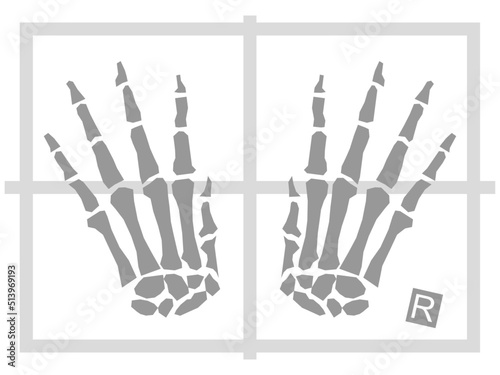 hands xray illustration