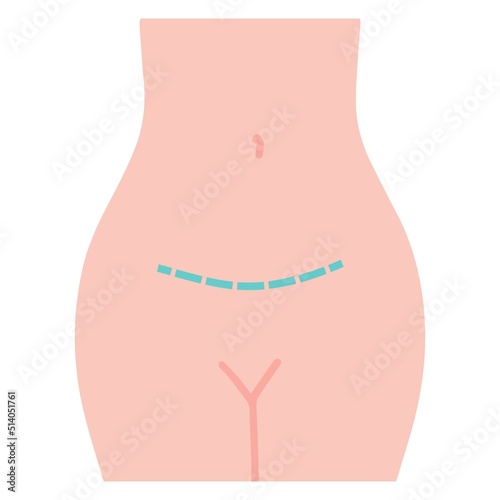 Gynecological surgery, problem with reproductive system.