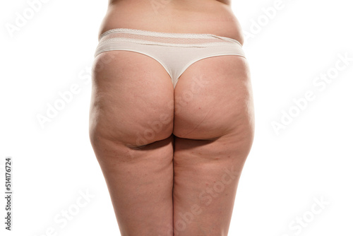 Overweight woman with fat cellulite legs and buttocks, obesity female body, white background