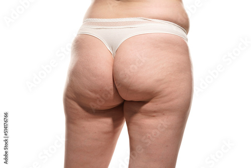 Overweight woman with fat cellulite legs and buttocks, obesity female body, white background