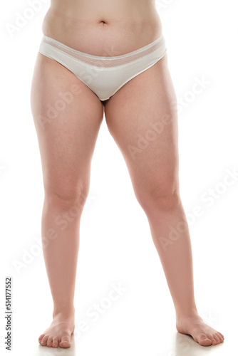 Front view of overweight woman with fat cellulite legs and belly, obesity female body, white background