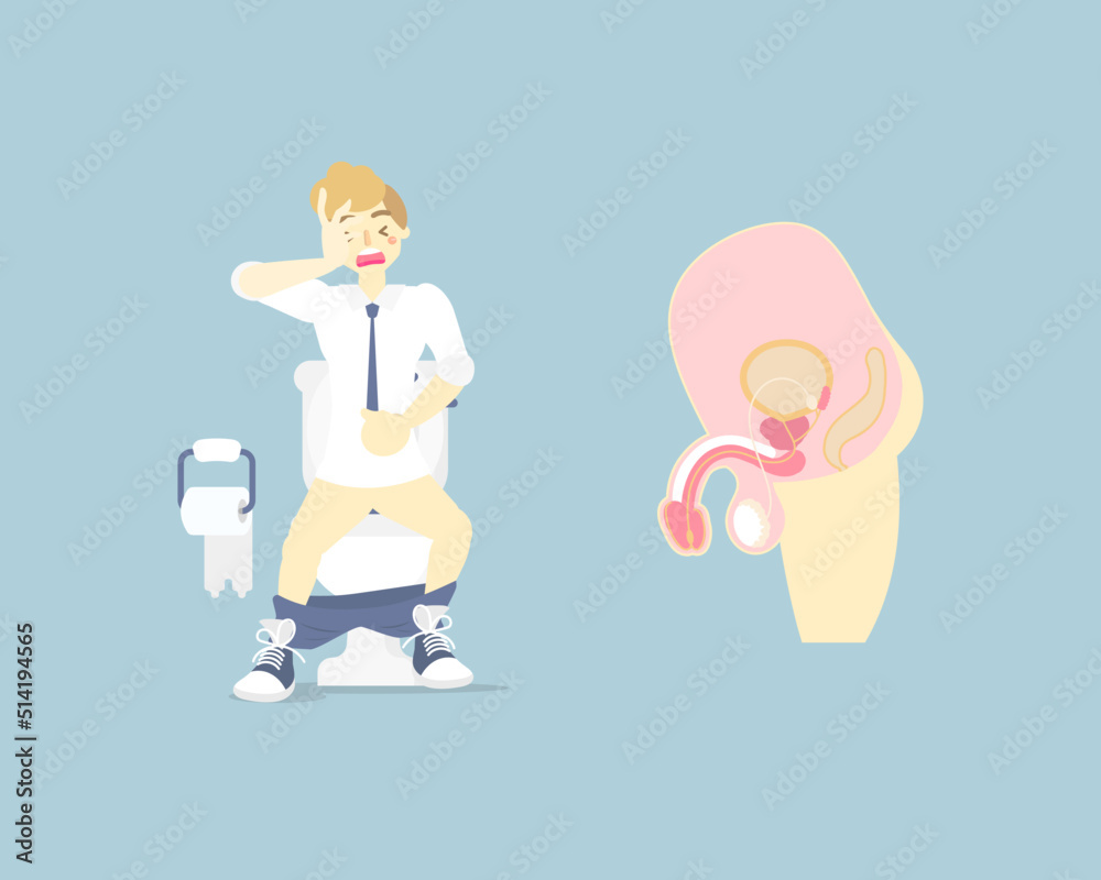 man using flush toilet, having stomach ache, suffering from diarrhea or constipation, male reproductive system, internal organs anatomy nervous system, vector illustration cartoon flat character man using flush toilet, having stomach ache, suffering from diarrhea or constipation, male reproductive system, internal organs anatomy nervous system, vector illustration cartoon flat character