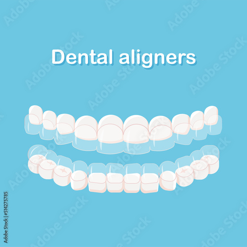 Mouth guard. Teeth with transparent braces. Alignment of teeth by aligners. Orthodontic dentistry concept. Dental care. Vector illustration isolated on blue background.