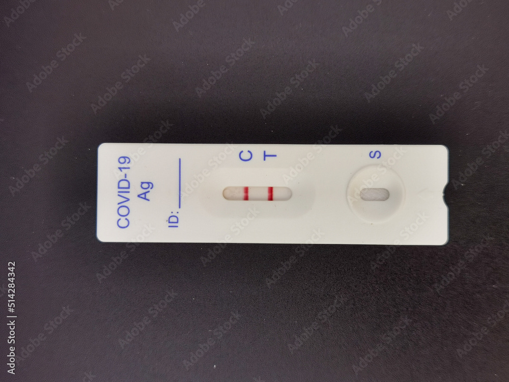 Rapid antigen test to detect the presence of the virus. The double red line identify a positive result. Rapid antigen test to detect the presence of the virus. The double red line identify a positive result.