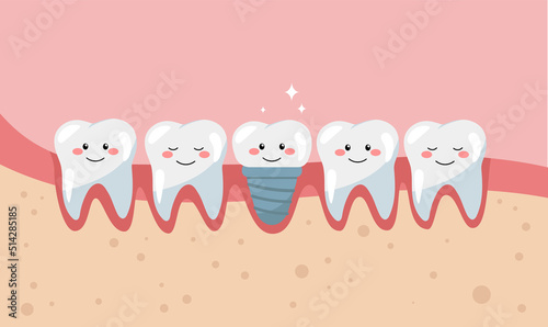 Dental implant concept. Tooth implantation. Implant. Dentistry and orthopedics concept.