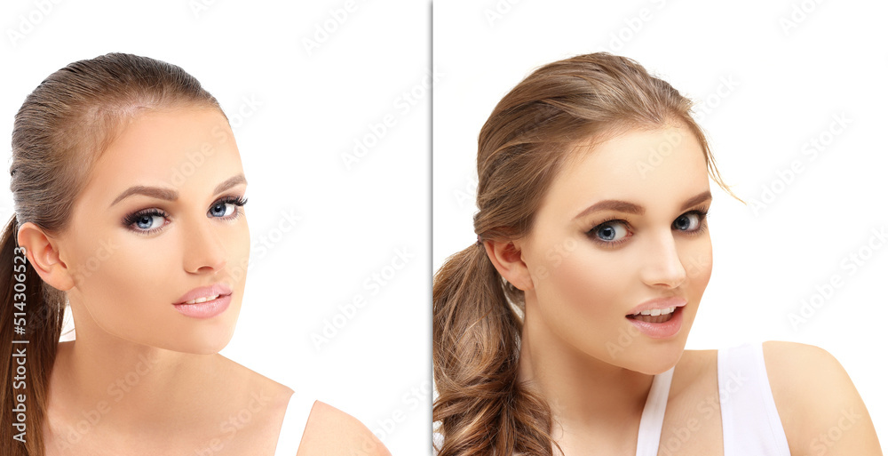 Thinning hair and hair loss,female pattern baldness,Hair transplant Thinning hair and hair loss,female pattern baldness,Hair transplant