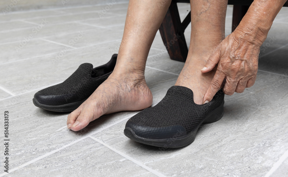 Elderly woman varicose veins feet puts on a shoes at home.