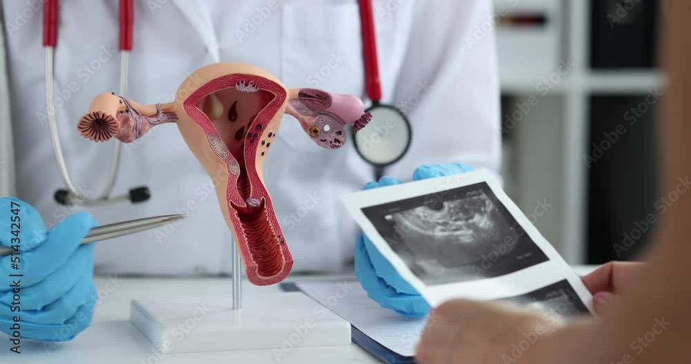 Gynecologist demonstrates model of female reproductive system to young woman in clinic closeup