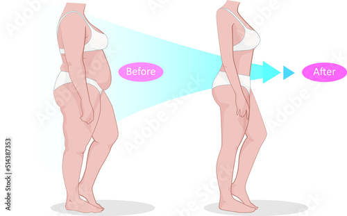 Shape before and after From fat woman to thin.
