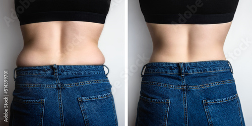 Slim and fat female sides on back comparison. Before and after weight loss.
