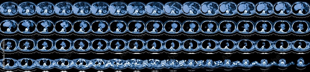 Magnetic Resonance Image (MRI) of chest organs Stock Photo | Adobe Stock