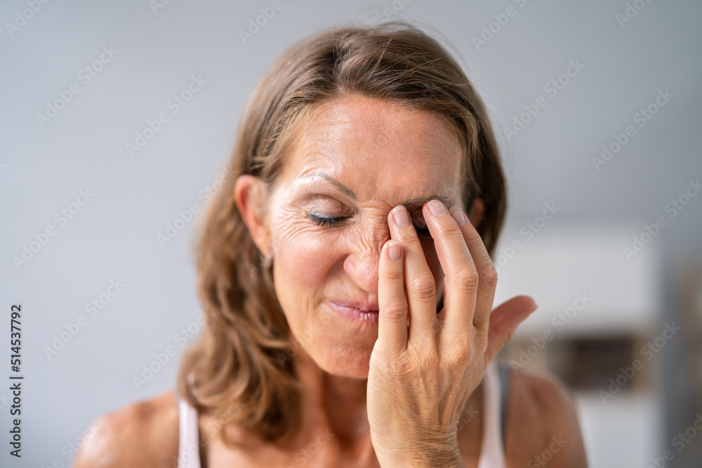 Eye Burning Pain Spasm And Fatigue Stock Photo Adobe Stock