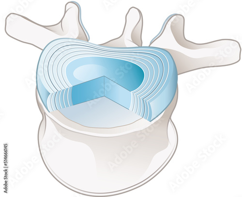 Healthy lumbar vertebrae and intervertebral disc. Labeled illustration photo