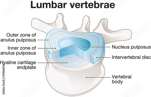 Healthy lumbar vertebrae and intervertebral disc. Labeled illustration photo
