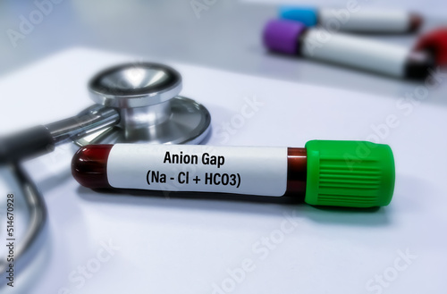Blood sample isolated for Anion Gap test to diagnose electrolytes balance including too acidic (acidosis) or little acidic (alkalosis). photo