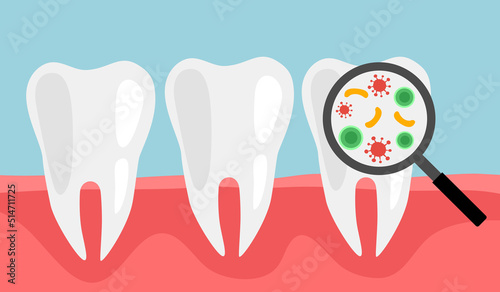 Magnifying glass tooth bacteria concept vector illustration. Dental health problem.