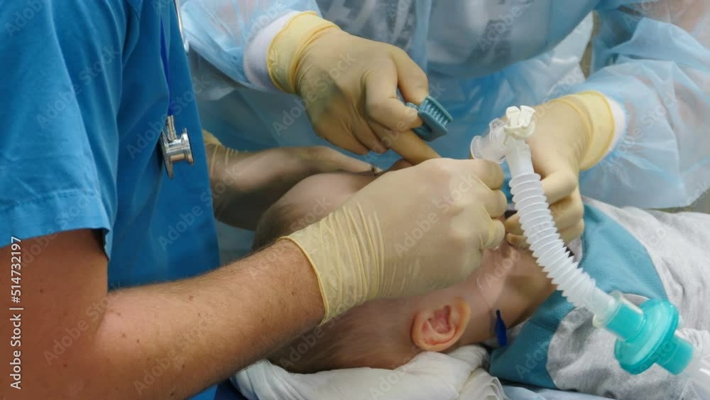 Little child under anaesthesia. Breathing mask on boy face. Health care